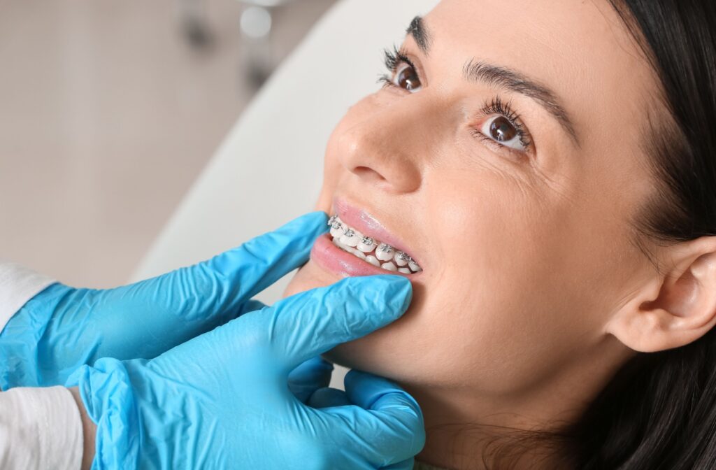 Patient receiving orthodontic treatment with braces to correct an overbite while seated in dental chair.