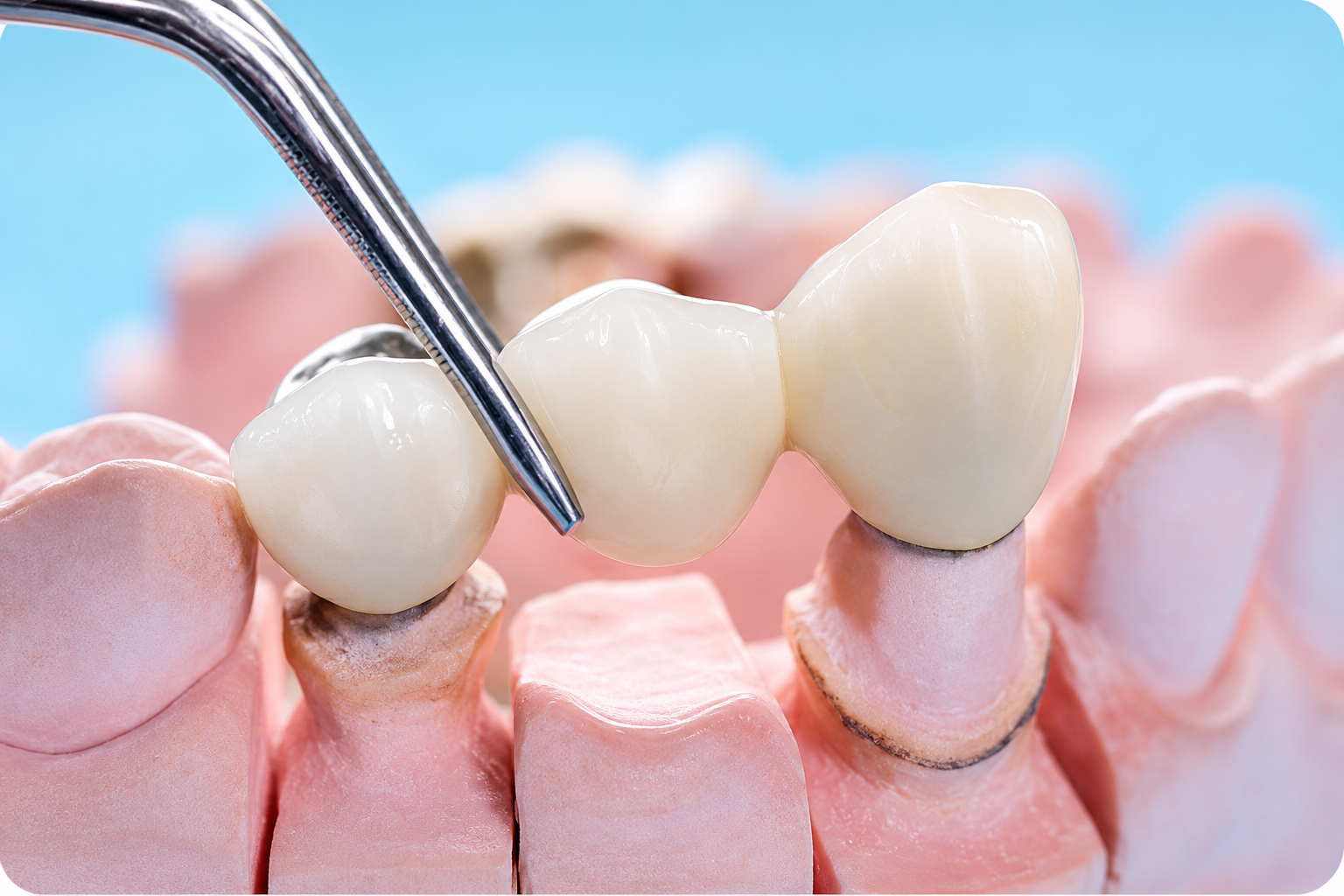 A close-up of a dental examination