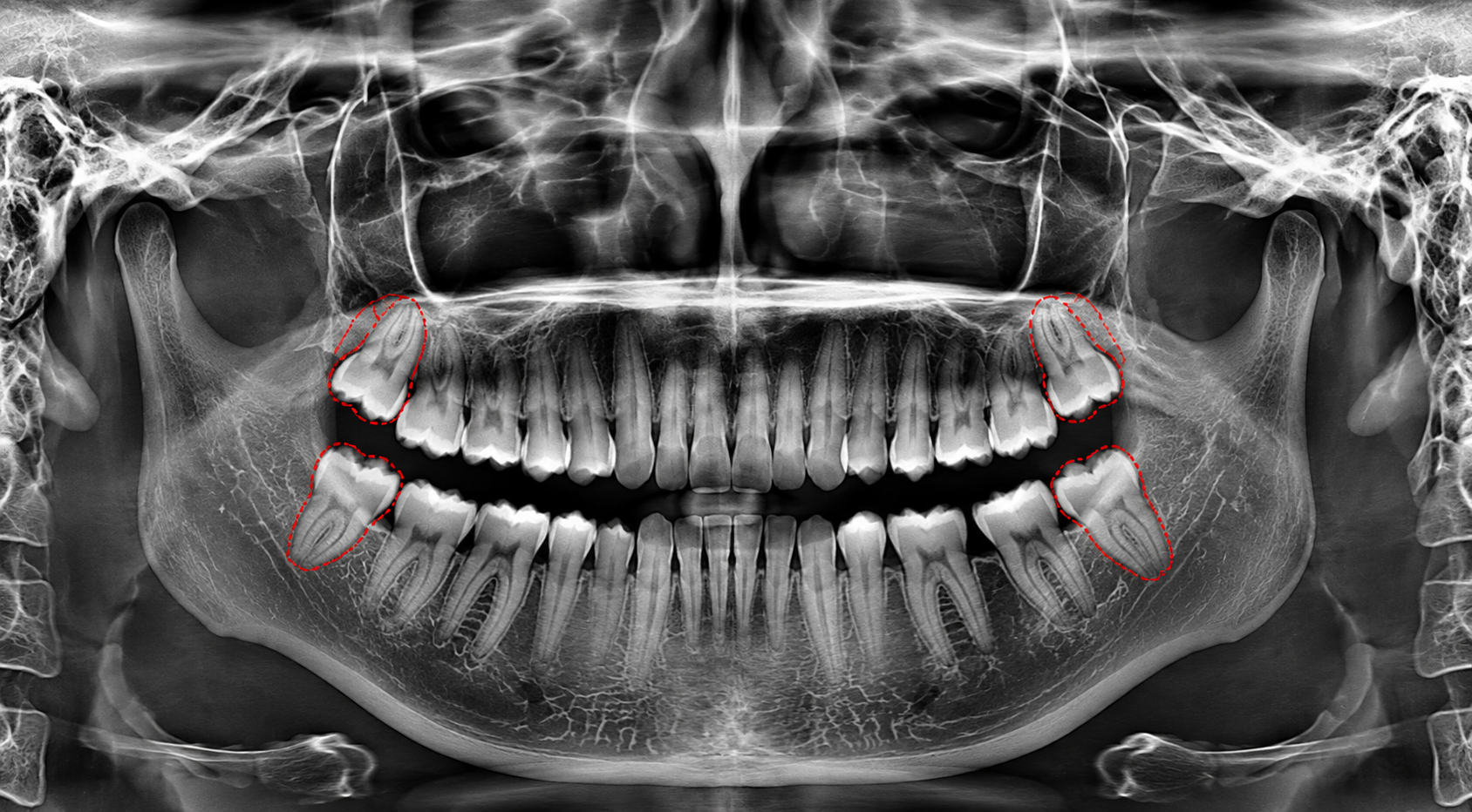 A dental professional discussing a tooth shade with a patient