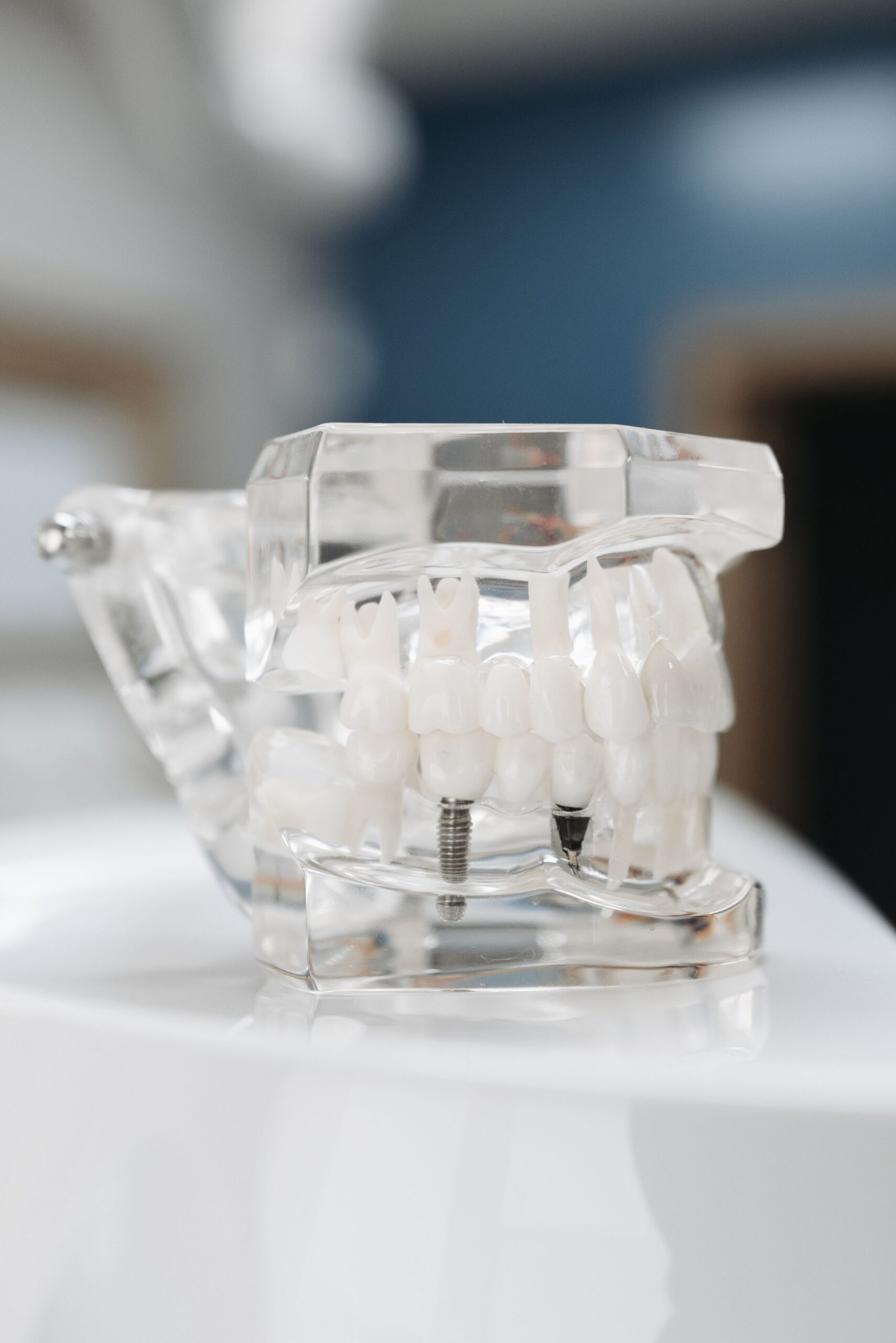 A dental model with a custom clear mouthguard