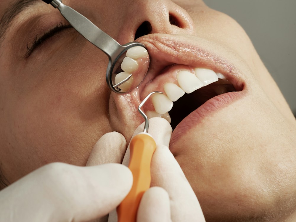 A close-up of a dental examination