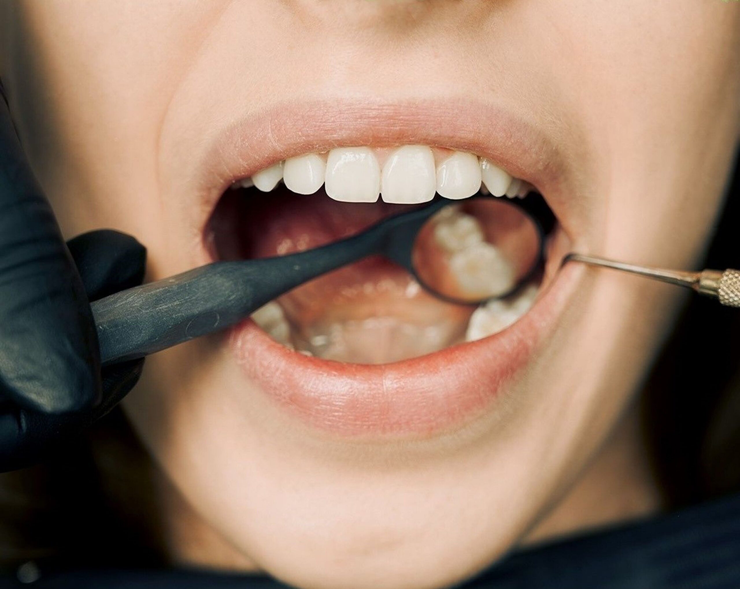 A dental professional showing a tooth model to a young patient