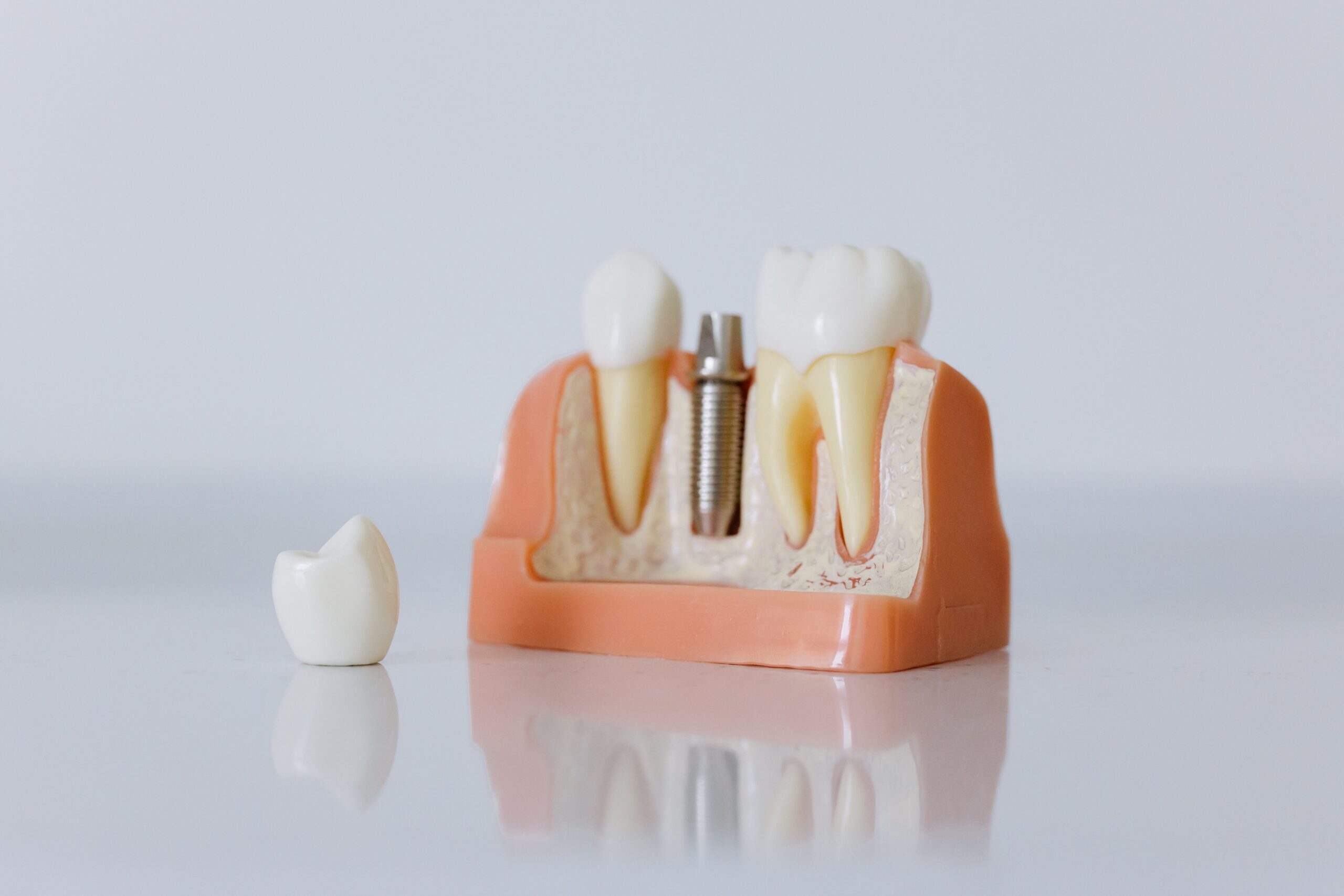 A dentist explaining an implant and crown to a patient