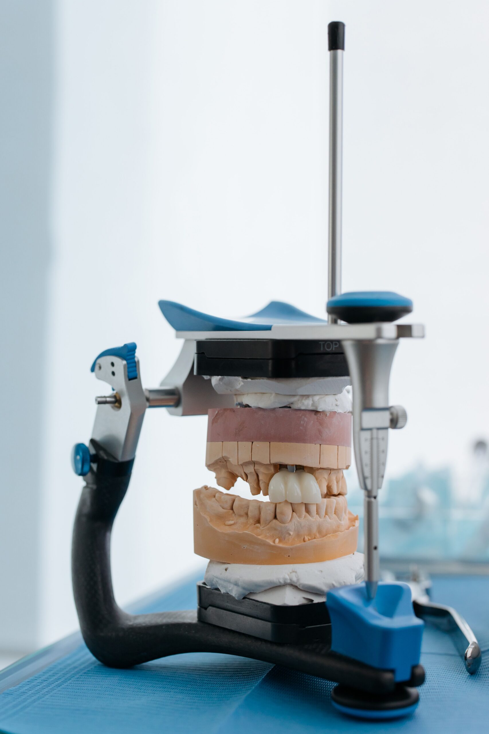 Dental implants