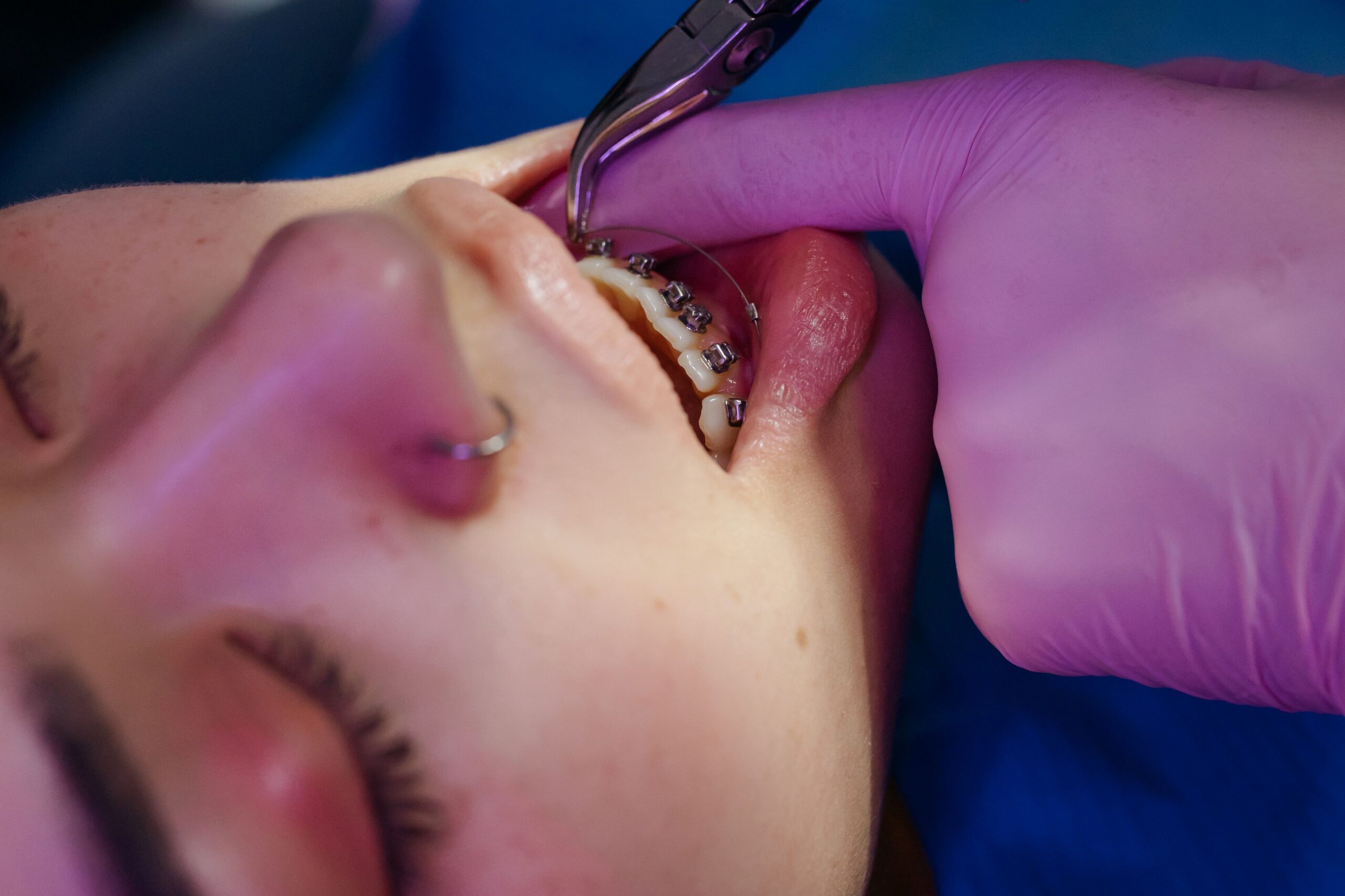 A close-up of a smiling patient holding a clear aligner