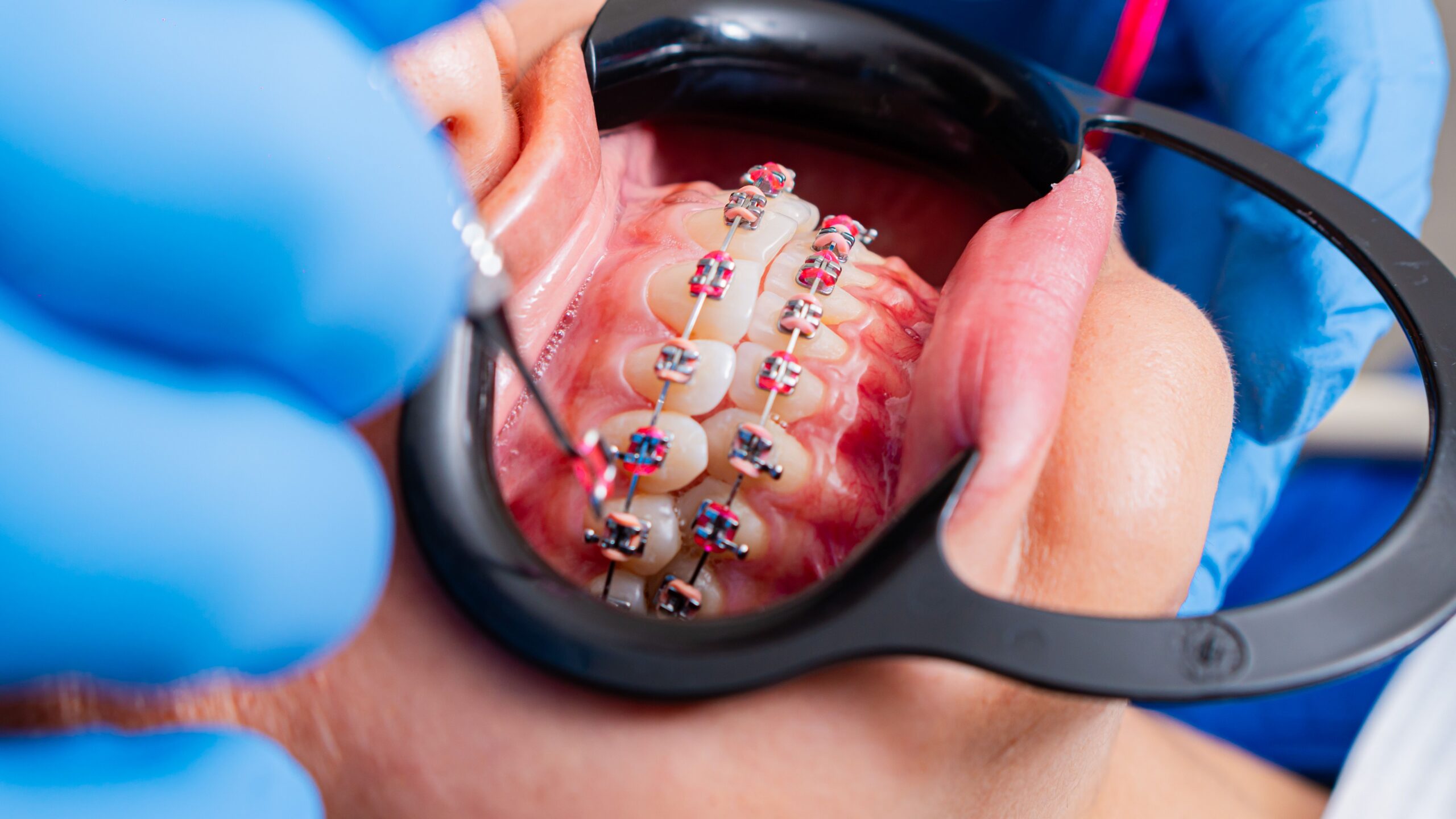 A dental professional discussing a tooth shade with a patient