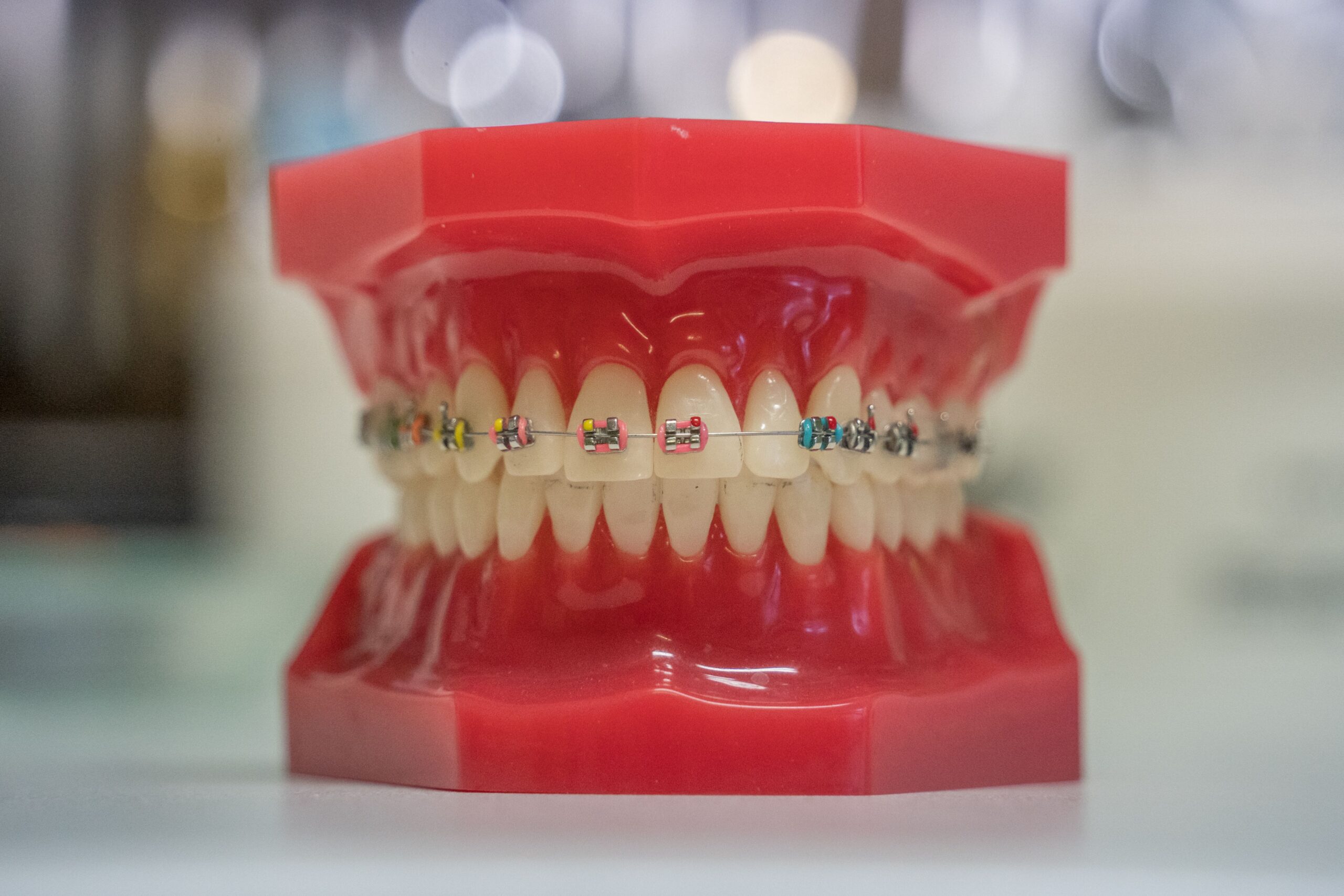 A young woman holding an orthodontic model and a clear aligner