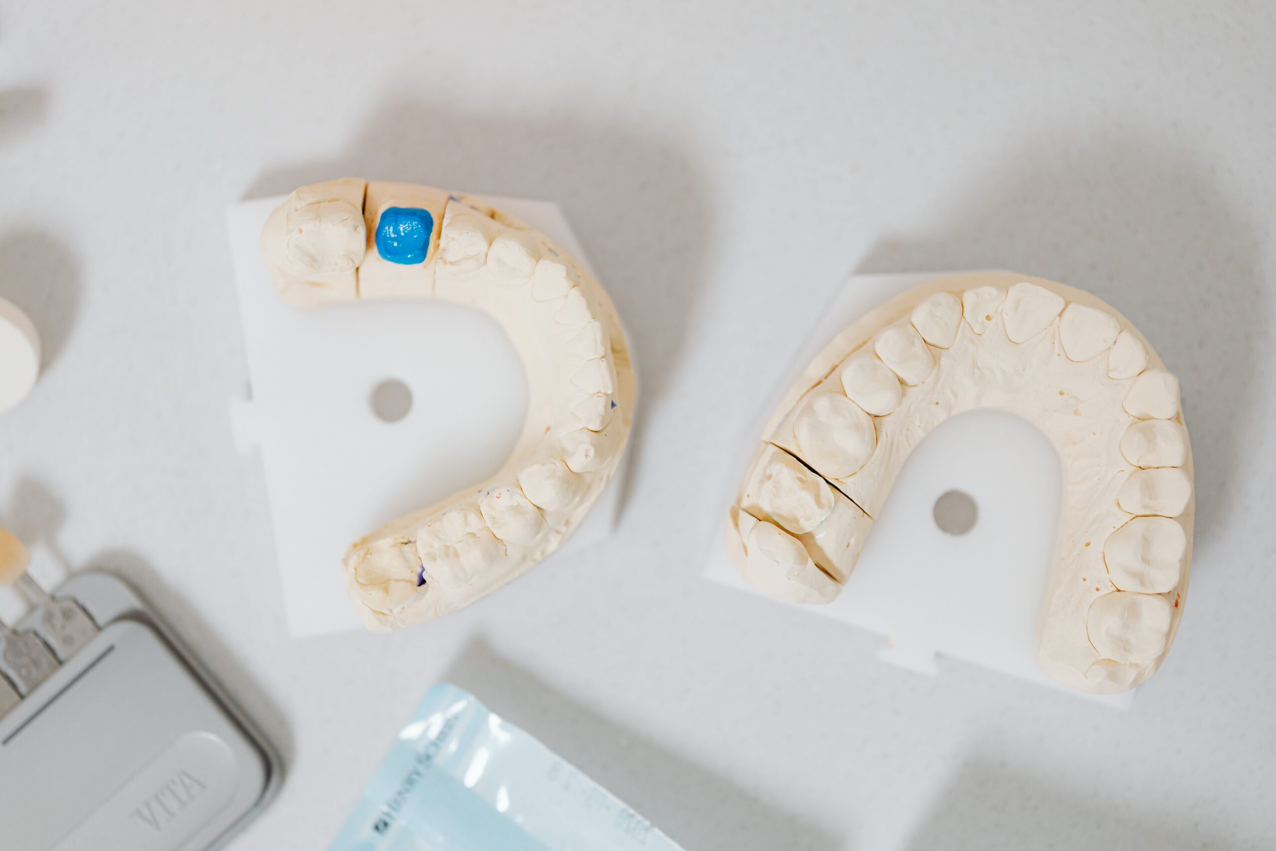 A dentist explaining an implant and crown to a patient