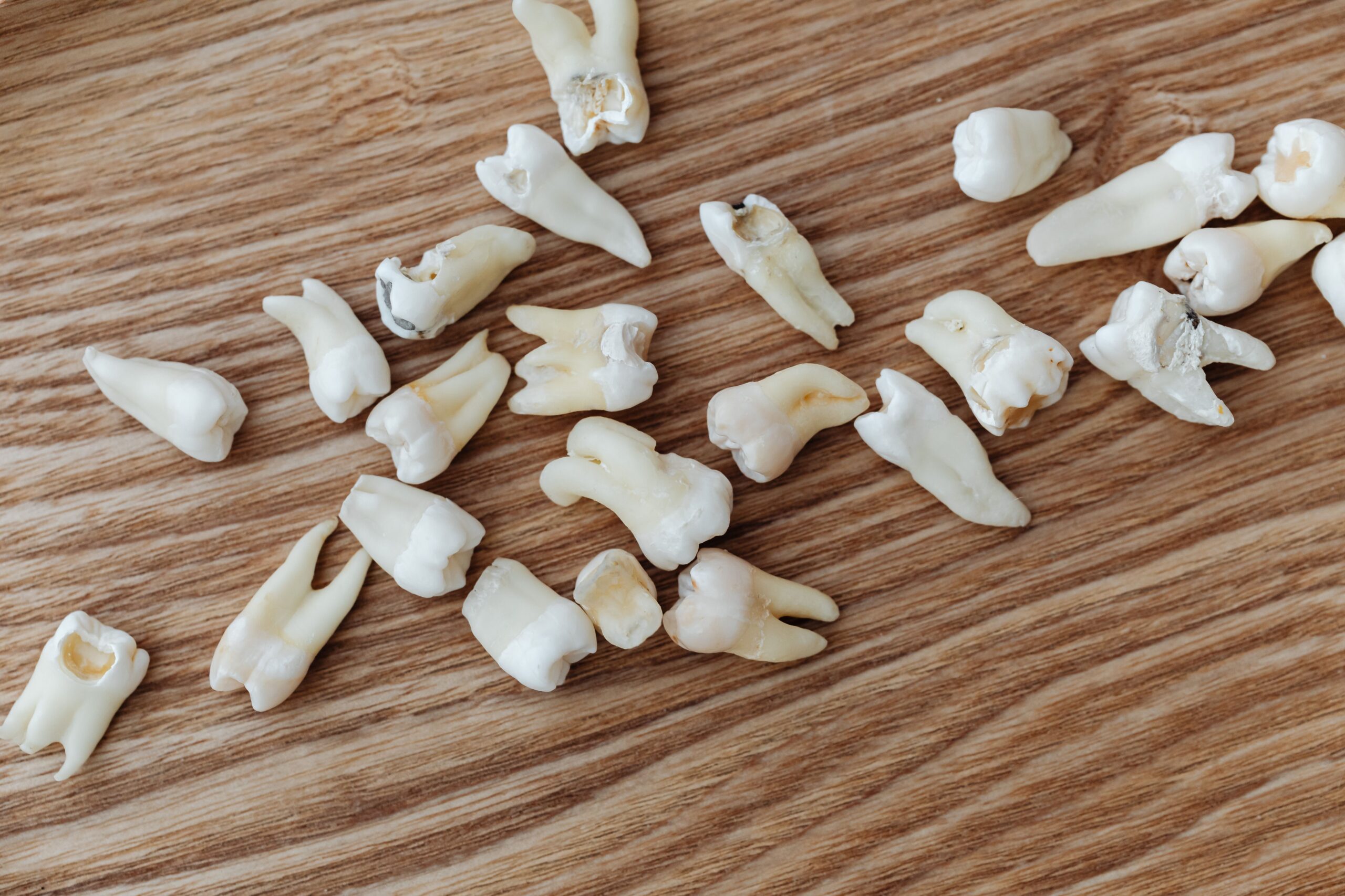 A close-up of a dental examination