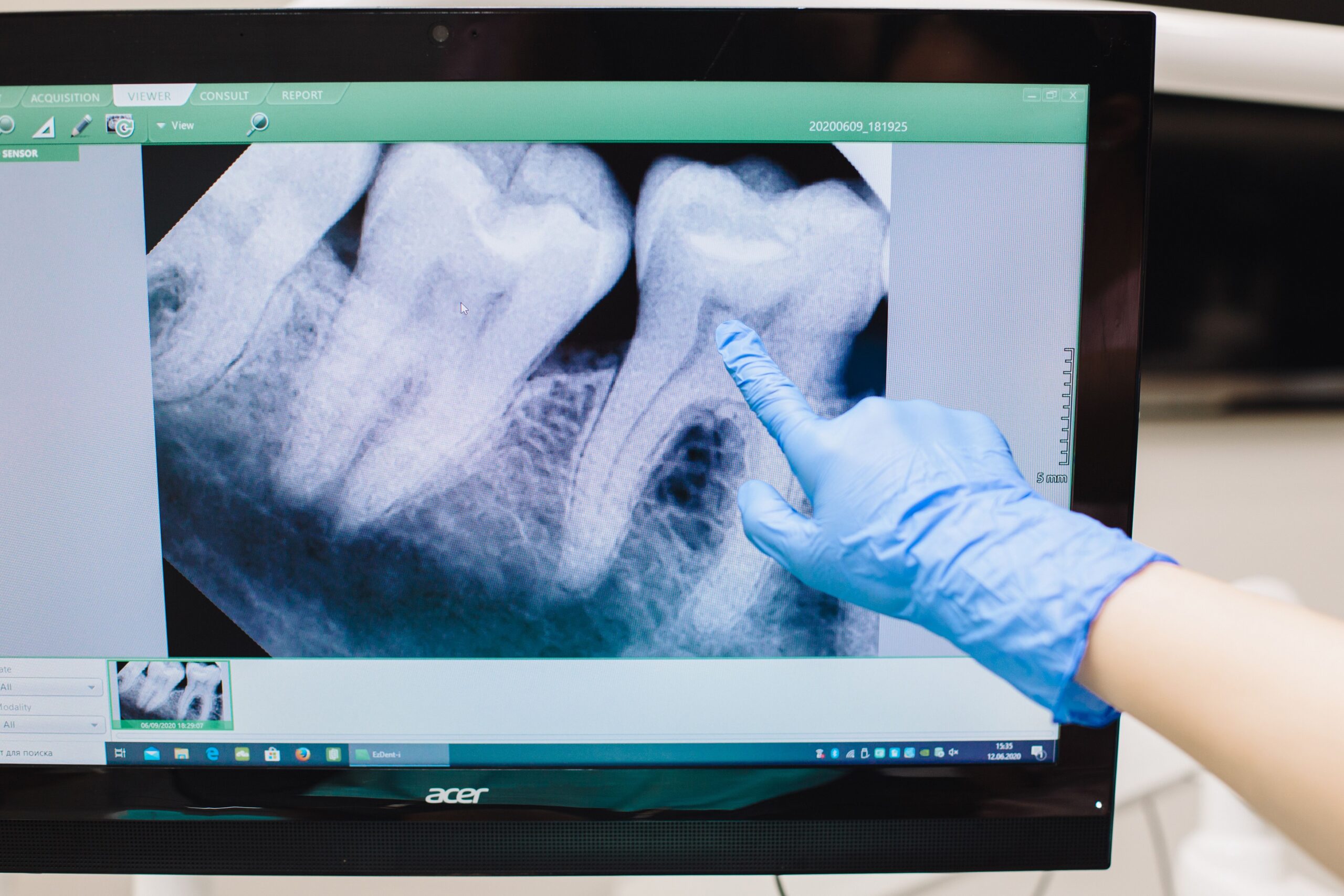 A dental professional discussing a tooth shade with a patient