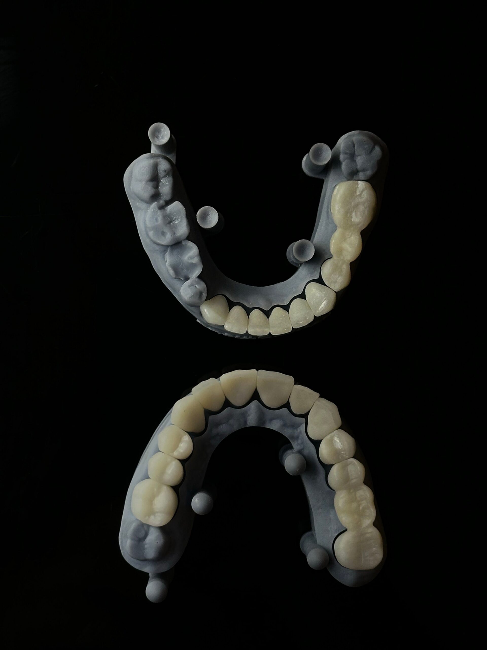 A dental professional discussing a tooth shade with a patient
